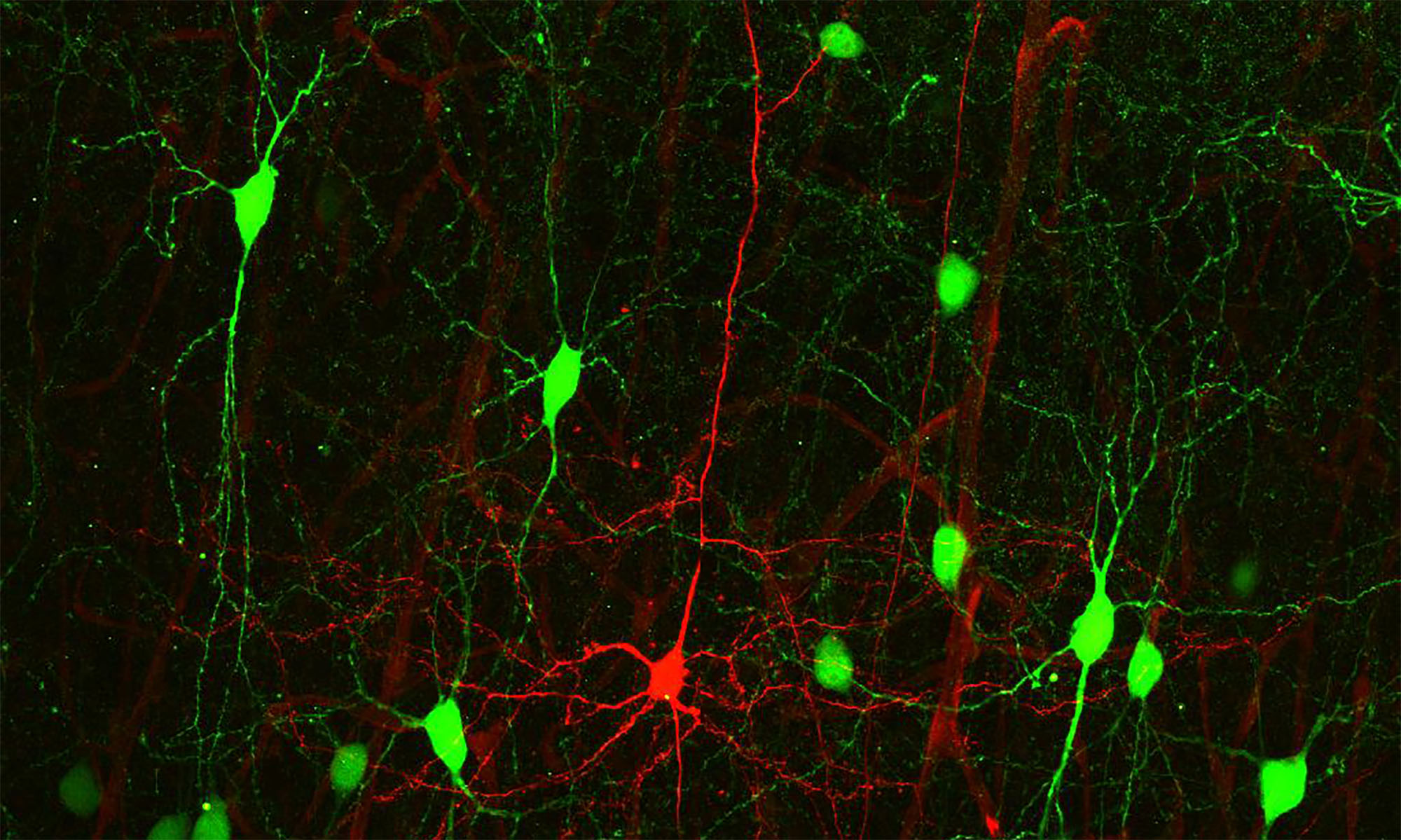 Layer 5 pyramidal neuron surrounded by SOM interneurons