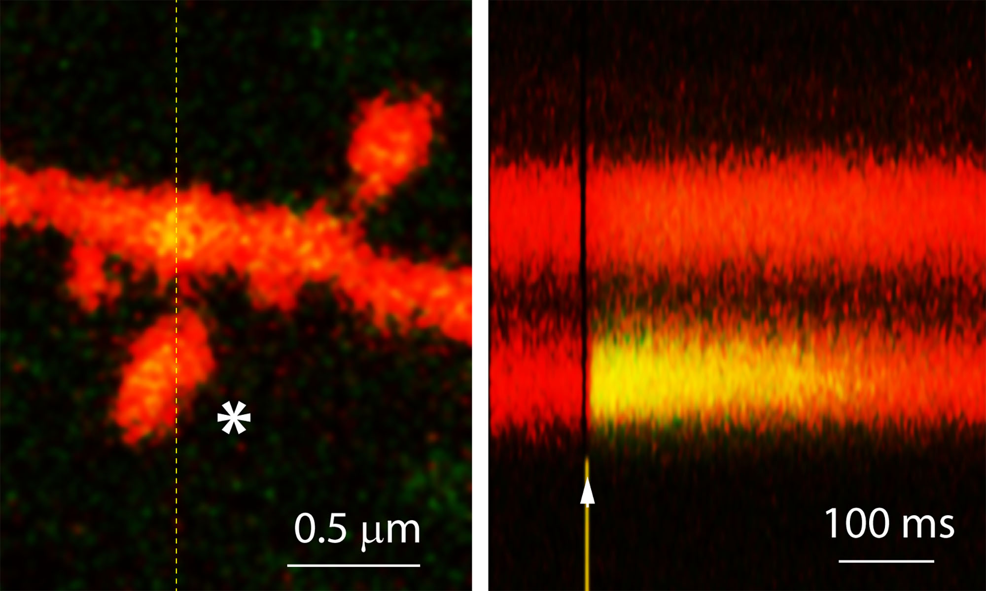 2-photon image of an uncaging evoked synaptic event