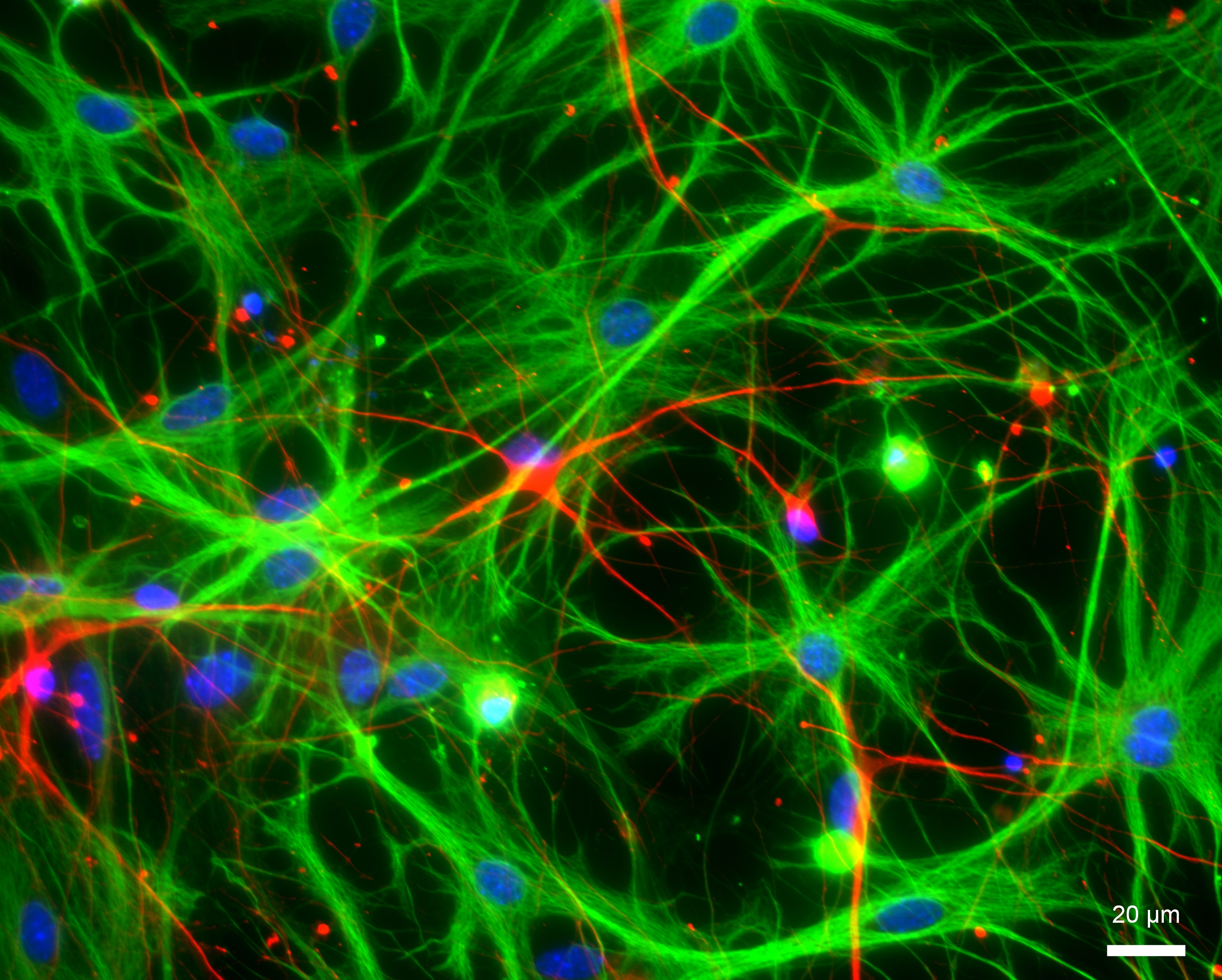 iPSC-derived neurons atop of astrocyte feeder layers
