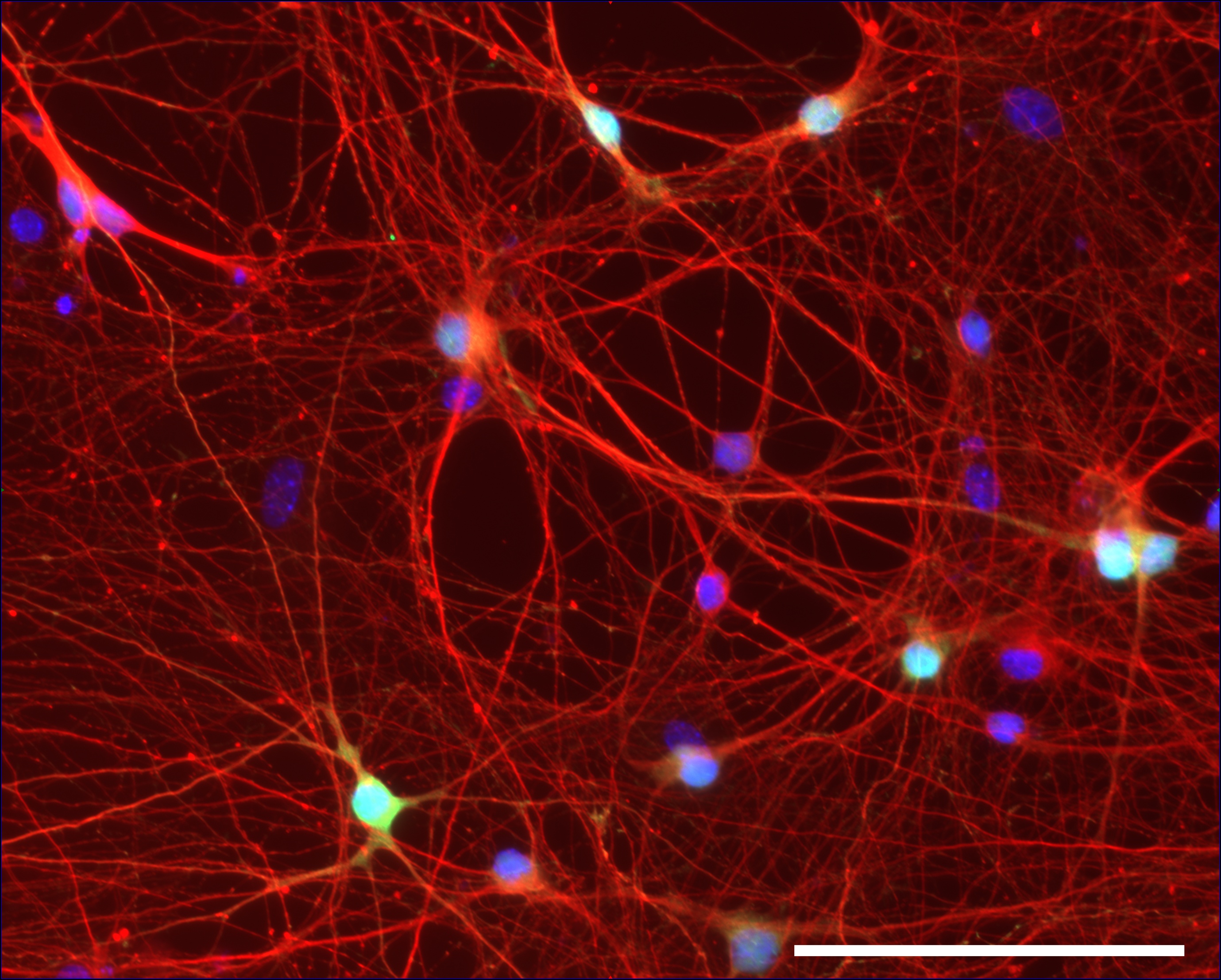 GABAergic neurons from a control individual