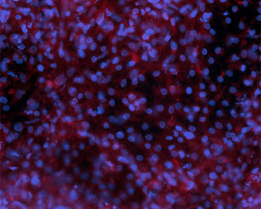 Osteoblasts TRITC fluorescence